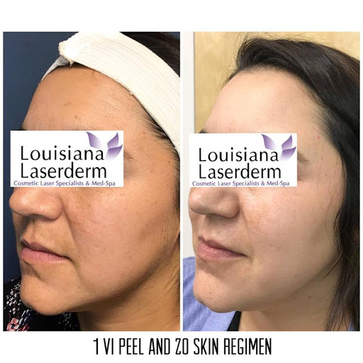 Explore world travel tattoo ideas, creative tattoo ideas in Baton Rouge, available at Louisiana Laserderm