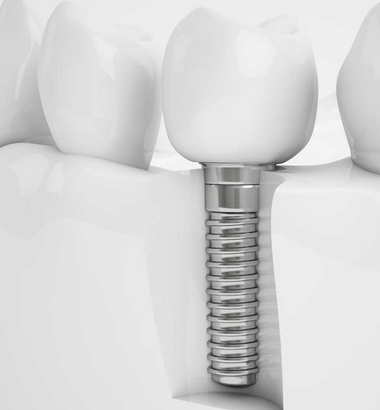 Sutor Periodontics & Dental Implants