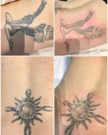 Explore inside bicep tattoo ideas, creative tattoo ideas in Middle Village, available at Bye Bye Ink Laser Tattoo Removal