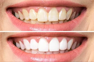 Signature Smiles Dental Clinic (Dr. Alka Pandey) - Best Dental Clinic in Hinoo Ranchi | RCT Specialist in Hinoo Ranchi image