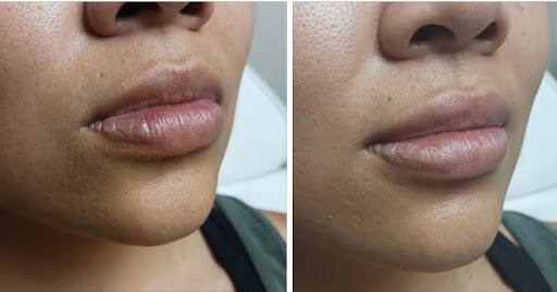 Explore lavender tattoo ideas, creative tattoo ideas in Edmond, available at Zen Aesthetics & Wellness Medical Spa