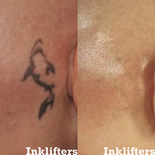 Explore ankle tattoo ideas for females, creative tattoo ideas in Pleasant Grove, available at Inklifters Tattoo Removal
