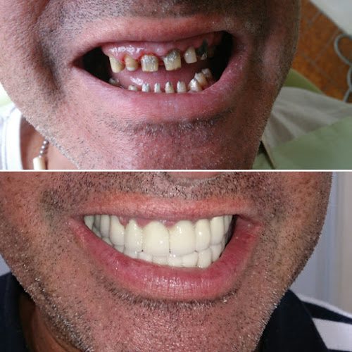 Dr. Kenny Sanchez (odontologo - Implantologo) - Guayaquil