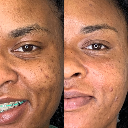 Beauty Salon «Glow Beauty Bar», reviews and photos, 4425 S Cobb Dr c, Smyrna, GA 30080, USA