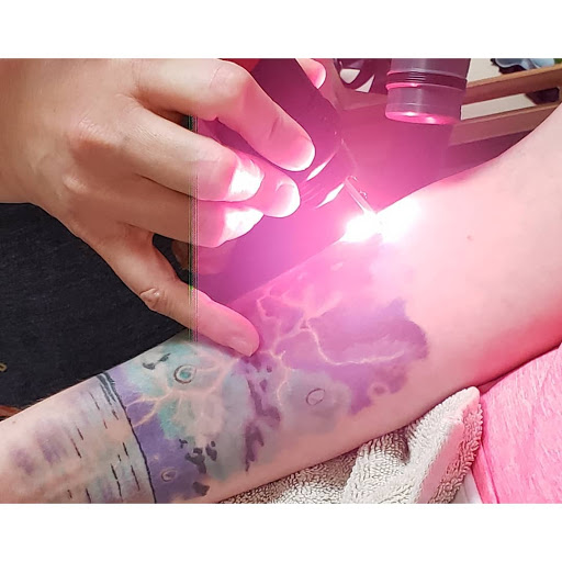 Explore 3x3 tattoo ideas, creative tattoo ideas in Weatherford, available at Vanish Laser Tattoo Removal and Skin Aesthetics