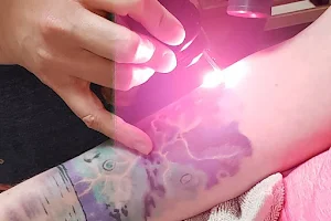 Vanish Laser Tattoo Removal and Skin Aesthetics image