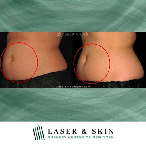 Explore haiti tattoo ideas, creative tattoo ideas in New York, available at Laser & Skin Surgery Center