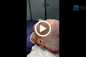 Zty Health - Hair Transplant - Plastic Surgery Turkey image