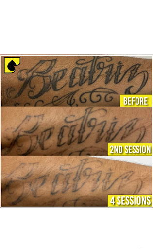 Explore recovering addict tattoo ideas, creative tattoo ideas in South Gate, available at Tattoo Removal Inc