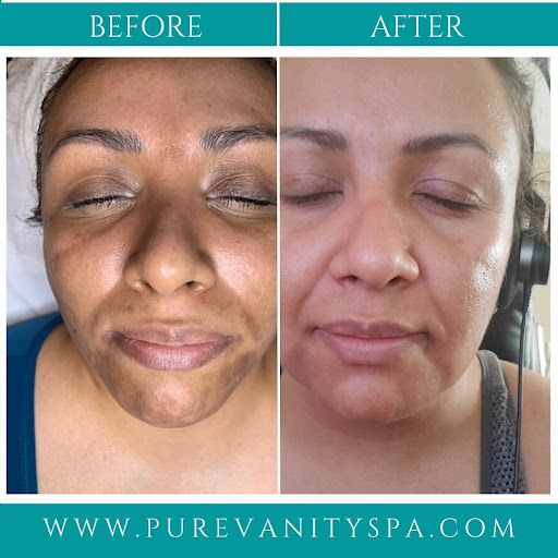 Laser Hair Removal Service «Pure Vanity Spa», reviews and photos, 20511 N Hayden Rd, Scottsdale, AZ 85255, USA