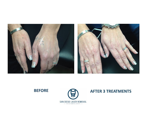 Explore theme tattoo ideas, creative tattoo ideas in San Diego, available at Removery Tattoo Removal & Fading