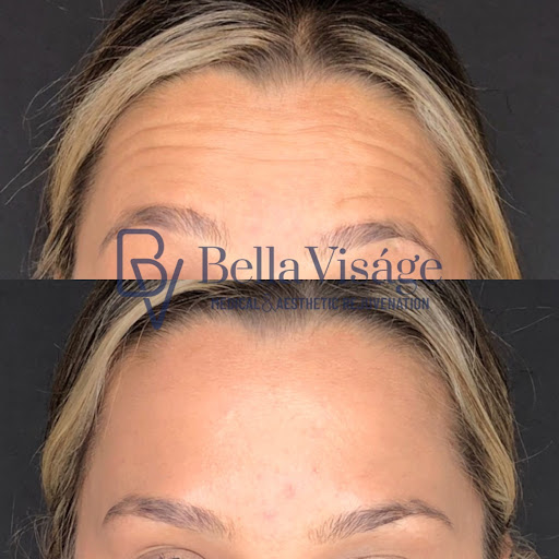 Explore jdm tattoo ideas, creative tattoo ideas in Lakeland, available at Bella Visge Medical & Aesthetic Rejuvenation