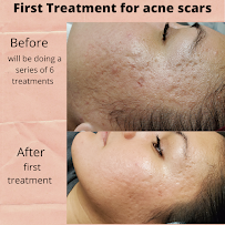 Facials by Deanna - Photo 4 - Car repair in Westlake Village, CA, Thousand Oaks