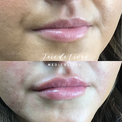 Explore giraffe tattoo ideas, creative tattoo ideas in Canton, available at JDV Med Spa