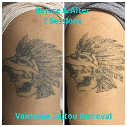 Explore et tattoo ideas, creative tattoo ideas in Milwaukee, available at Removery Tattoo Removal & Fading