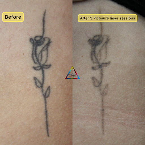 Explore nautical sleeve tattoo ideas, creative tattoo ideas in New York, available at Ag2g Laser Tattoo Removal & MedSpa