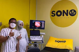 Sonobee Ultrasound Bukit Sentosa image