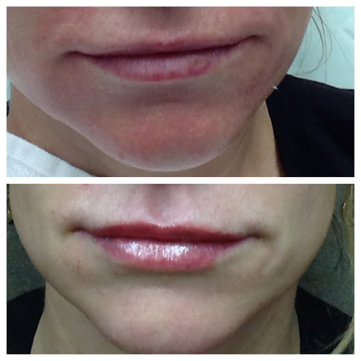 Medical Spa «Carillon Minneapolis Anti-Aging & Skin Clinic», reviews and photos, 755 Bielenberg Dr #104, Woodbury, MN 55125, USA