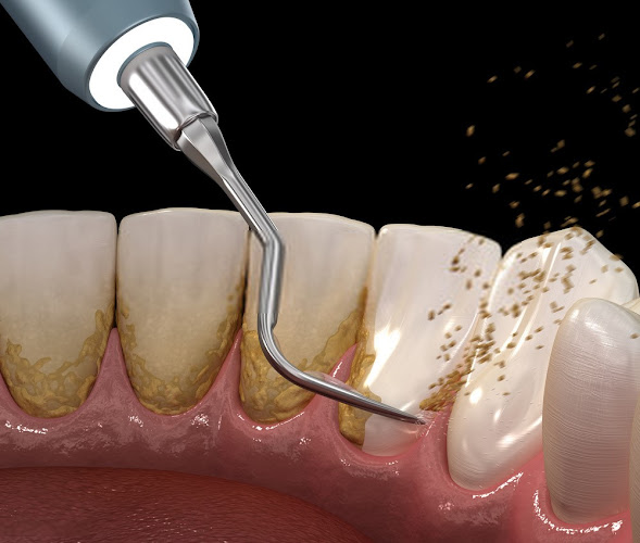 Comentarios y opiniones de Dr. Jorge Pizarro, Cirujano Dentista - Clínica Dental - Endodoncias