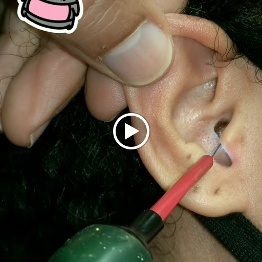 Sherman Oaks Ear and Hearing Aid institute - Tinnitus, Musician Devices, Hearing Loss Specialist image