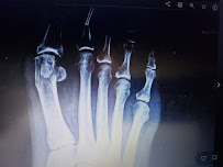 Raleigh Foot & Ankle Center - Photo 8 - Car repair in Raleigh, NC, Raleigh