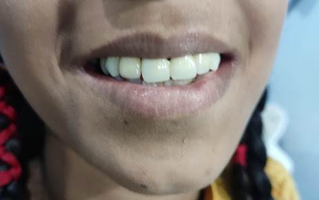 Sri Sai Ashritha Multispeciality Dental Clinic - Sri Sai Ashritha Multispeciality Dental Clinic