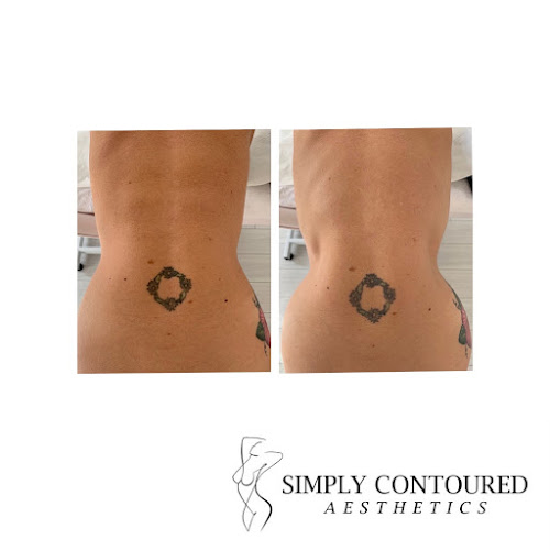 Comments and reviews of Simply Contoured Aesthetics