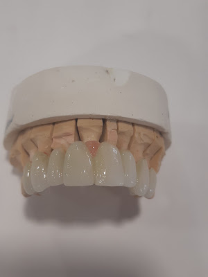 Laboratoire Fraysse Dental Création (LFDC) à Limoges