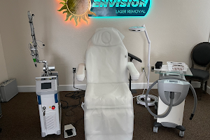 Envision Laser Removal image