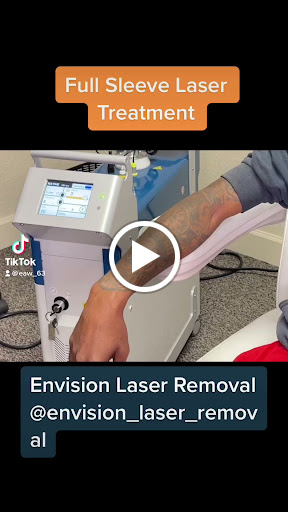Explore background filler tattoo ideas, creative tattoo ideas in Port Charlotte, available at Envision Laser Removal