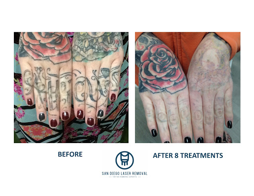 Find mother tattoo ideas for your next unique tattoo in San Diego at Removery Tattoo Removal & Fading