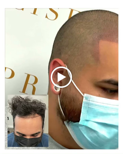 Precise Scalp Micro - Scalp Micropigmentation Service and Training image