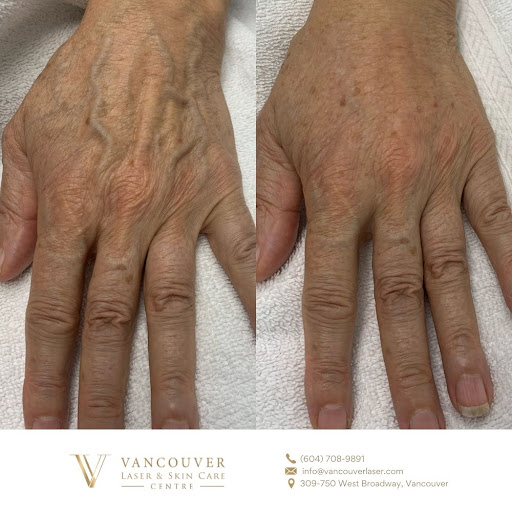 Vancouver Laser & Skin Care Centre