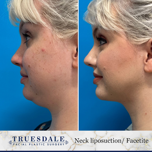 Truesdale Facial Plastic Surgery image