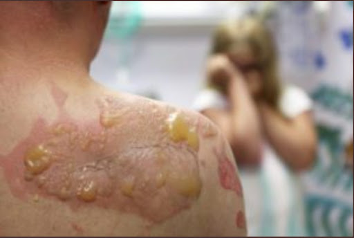 Personal Injury Attorney «Russell & Lazarus APC, Newport Beach Personal Injury Lawyer», reviews and photos