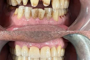 Smile On Dental Studio,Implant Centre image