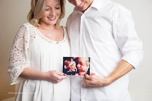 Motherhood Ultrasound | 13 Weeks Gender image