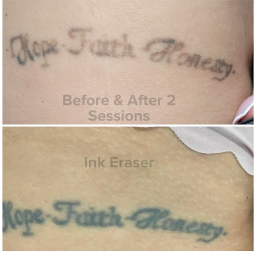 Explore rammstein tattoo ideas, creative tattoo ideas in Tucson, available at Allure Medical