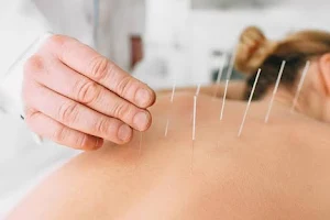 RKM Acupuncture Treatment & Training Centre image