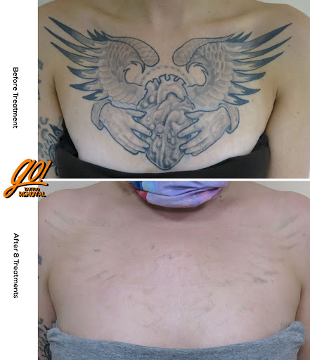 Explore tattoo ideas for men chest, creative tattoo ideas in Allentown, available at Removery Tattoo Removal & Fading