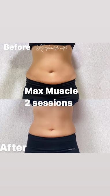 كاتي هيئة النحت - Katy Body Sculpt