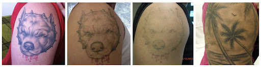 Explore willy wonka tattoo ideas, creative tattoo ideas in San Antonio, available at MEDermis Tattoo Removal