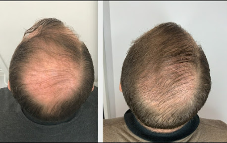 Nordic Hair - Nordic Hair