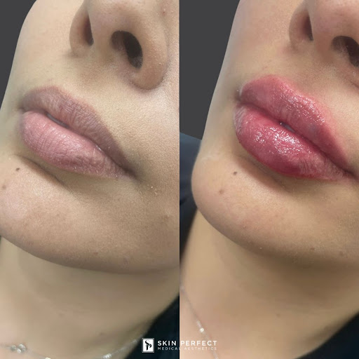 Explore hawk tattoo ideas for females, creative tattoo ideas in Whittier, available at Skin Perfect Medical Aesthetics