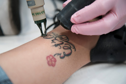 Explore dog grooming tattoo ideas, creative tattoo ideas in Meridian, available at LaserAway