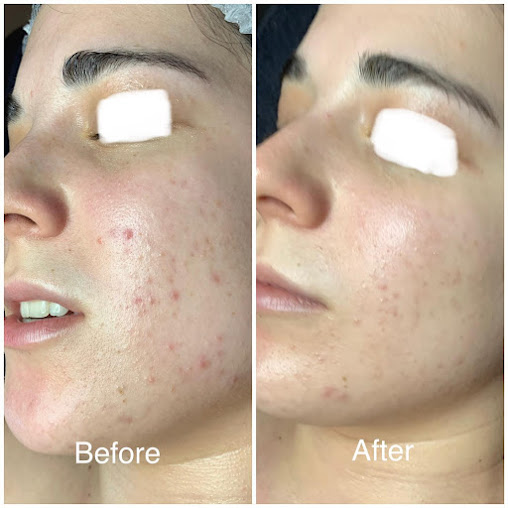 Simply Skin at Tamzyn - Simply Skin at Tamzyn