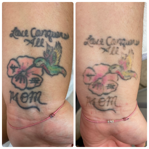 Find japanese tattoo ideas for women for your next unique tattoo in Middle Village at Bye Bye Ink Laser Tattoo Removal