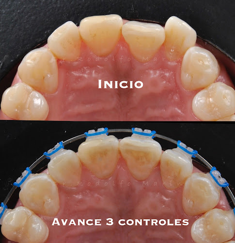 Opiniones de Clínica Juncal en Los Andes - Dentista