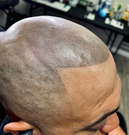 Luxury SMP Scalp Micropigmentation