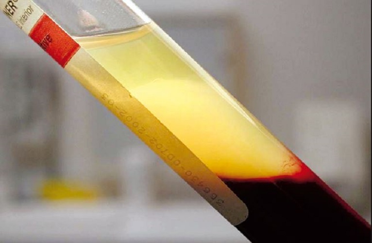 Blood and Plasma Research, Inc 77707